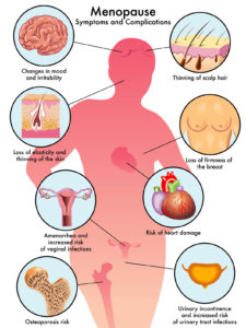 sintomi menopausa