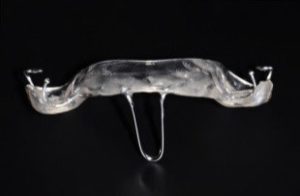 apparecchio roncopatia