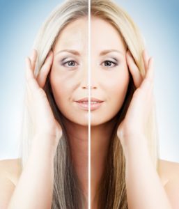medicina estetica viso prima e dopo