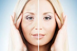 medicina estetica viso prima e dopo