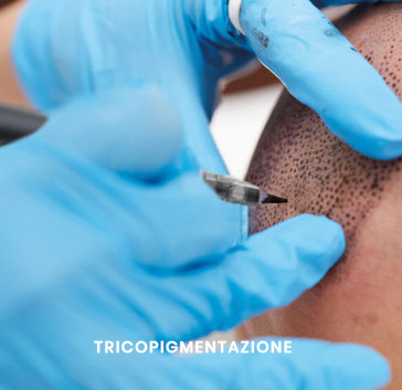 tricopigmentazione_opt