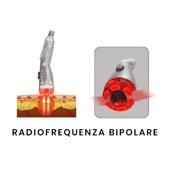 radiofrequenza bipolare