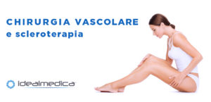 chirurgia vascolare