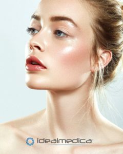 donna con filler viso