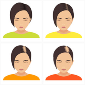fase caduta capelli donna