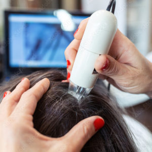 macchina trapianto capelli