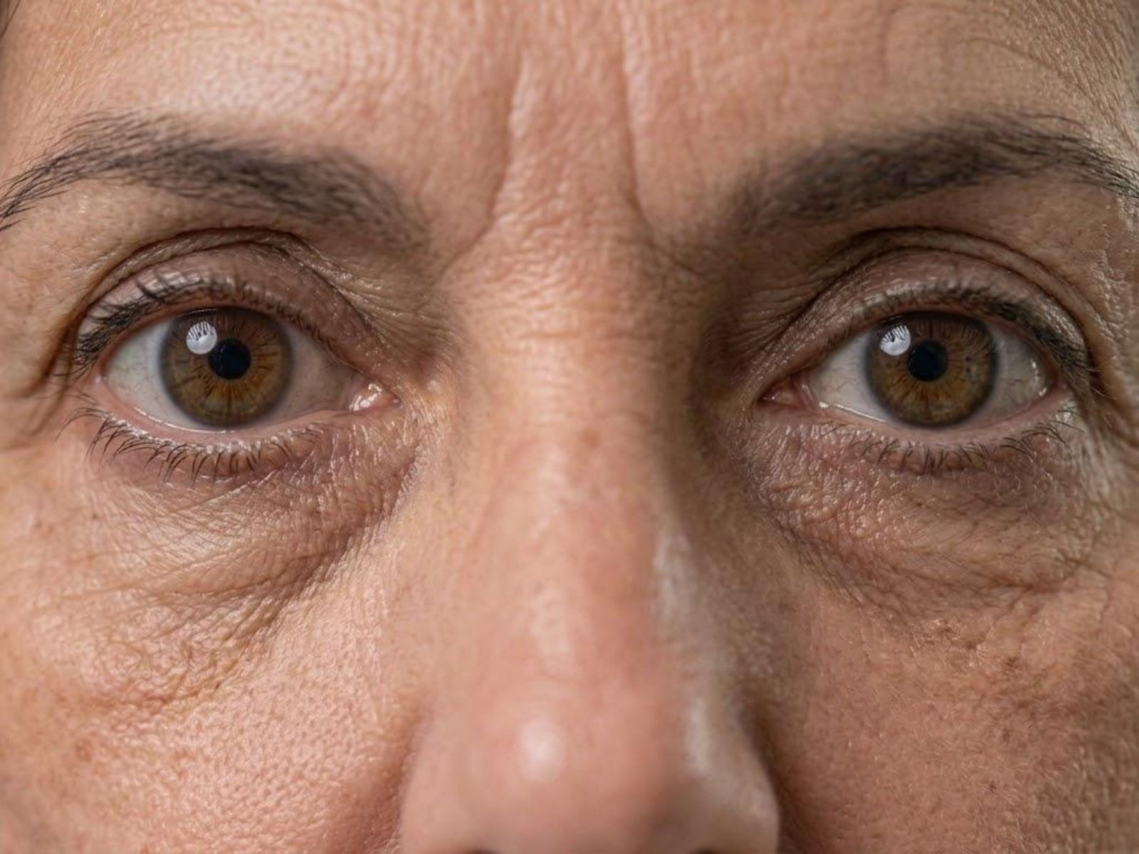 Invecchiamento dello sguardo — trattamenti di medicina estetica in Idealmedica.