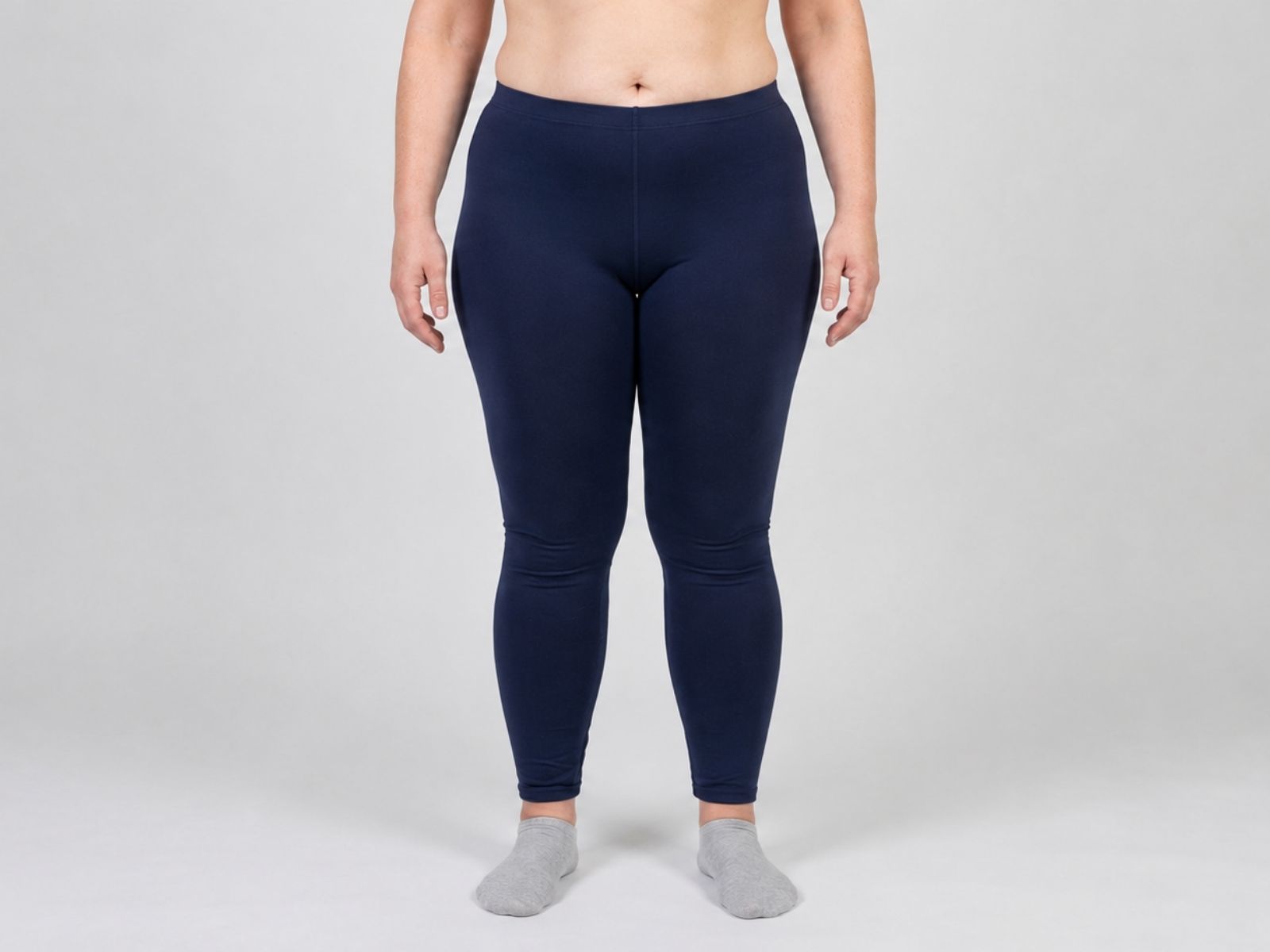 Lipedema — trattamenti di medicina estetica in Idealmedica.